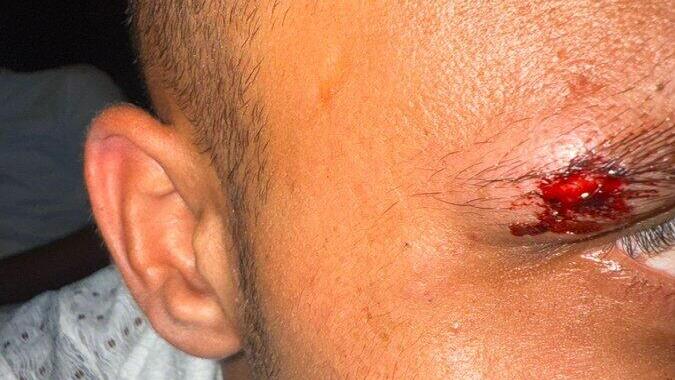 הישראלים שהותקפו