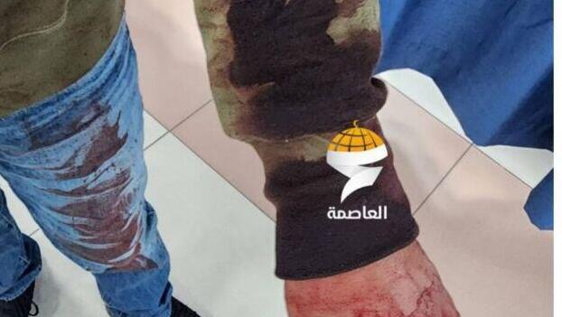 ארבעה פלסטינים פצועים