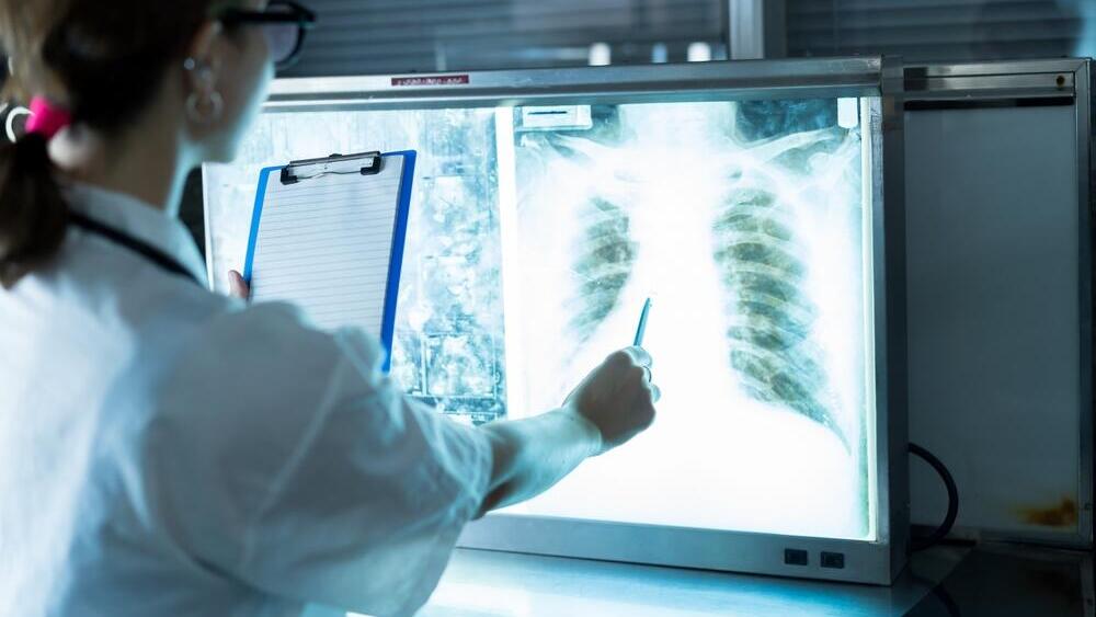 Фото: shutterstock