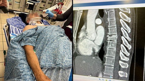 רוכב האופניים שהותקף בידי נערים