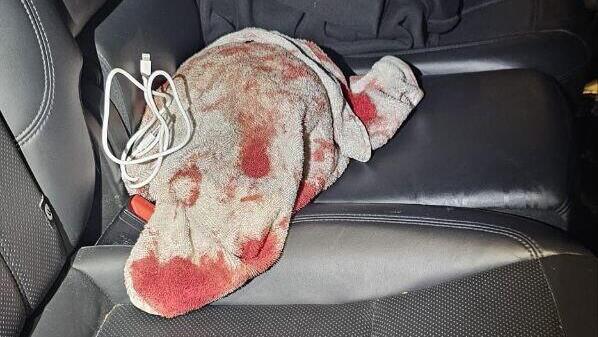 Окровавленное полотенце в машине похищенного (Фото: пресс-служба полиции) מהחטיפה