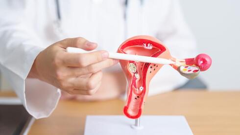 סרטן השחלות