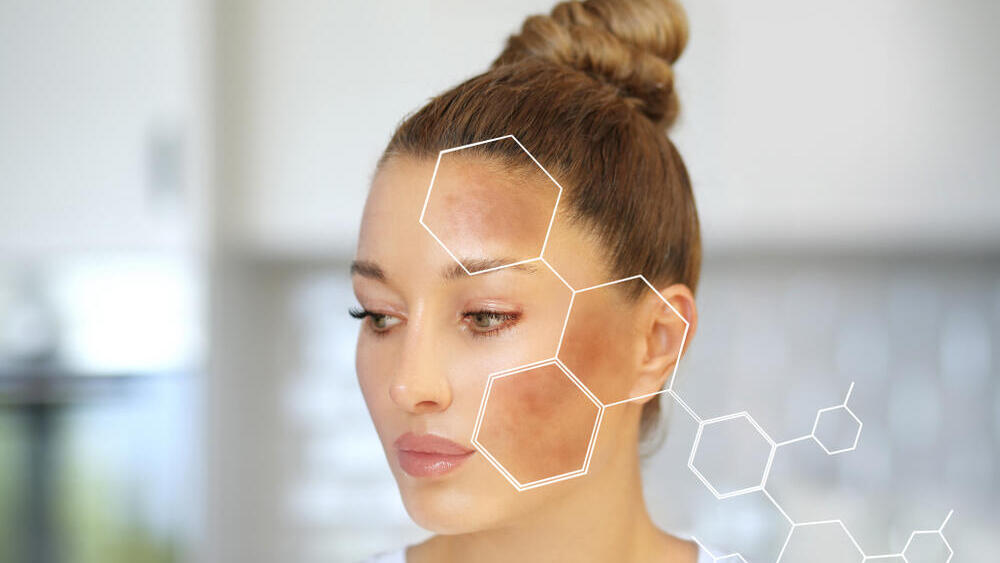 Фото: shutterstock