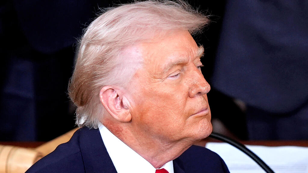 נשיא ארה"ב דונלד טראמפ סובל מפריחה בעור, צולם ב-24.2