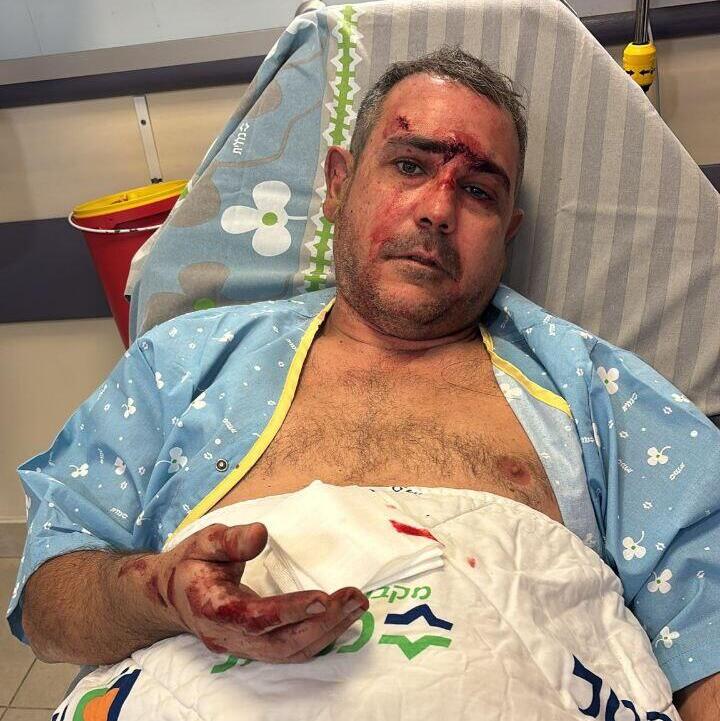 בן אביטל. פצוע קל מאושפז ביוספטל