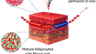 Graphic abstract (from bottom left, clockwise): Muscle tissue containing mature cells and vascular networks; fat tissue containing blood vessels and lymphatic networks; printing of these flaps; and immediate perfusion of the flap by the host tissue 