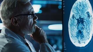 ct מוח הדמיה