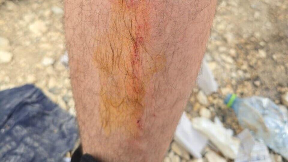 עימותים אלימים בין שוטרים לחרדים בירושלים