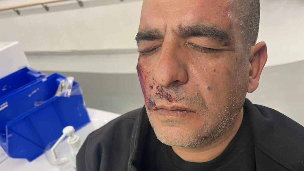 נהג האוטובוס עלי מוסא תושב מזרח ירושלים שהותקף