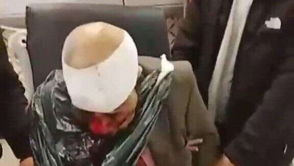 פלסטיני שהותקף על ידי מתנחלים בתיאסיר