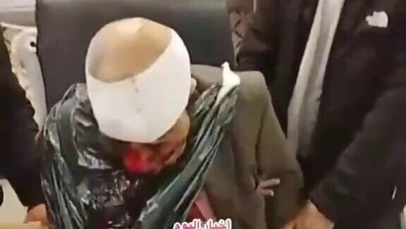 פלסטיני שהותקף על ידי מתנחלים בתיאסיר