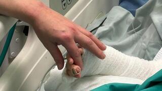 ילד בן ארבע נכווה קשות לאחר שמעד לסיר מרק רותח בבית כנסת ומטופל בטיפול נמרץ בהדסה עין כרם