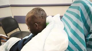 עיסא בן ה-12  נער סודני  נפצע באורח בינוני מ שברי יירוט ב אילת עיר מגוריו 