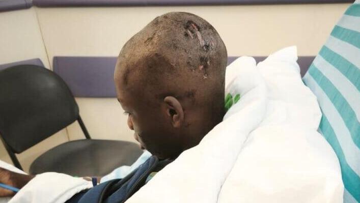 "הוא כל הזמן מפחד": מי ידאג לילד שנפצע משברי יירוט