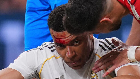 אמבאפה מדמם מפניו