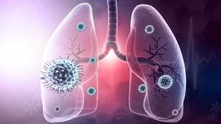 ריאות, קורונה