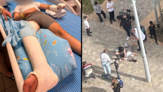 הילדה שנדרסה על ידי קורקינט חשמלי באור יהודה