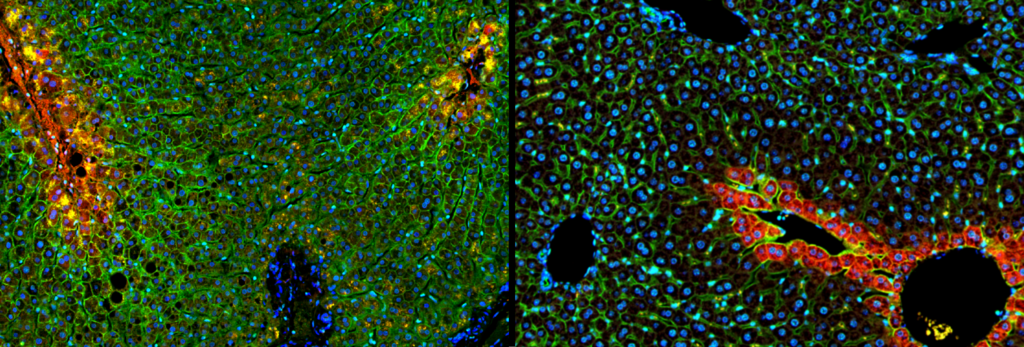 הבדל בין כבד אנושי לכבד של עכבר, מחקר מיפוי כבד