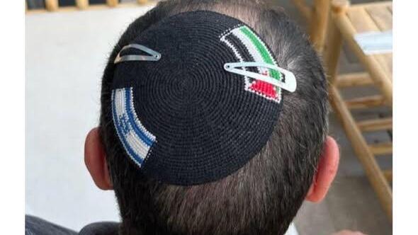 הכיפה שנגזרה על ידי שוטרים