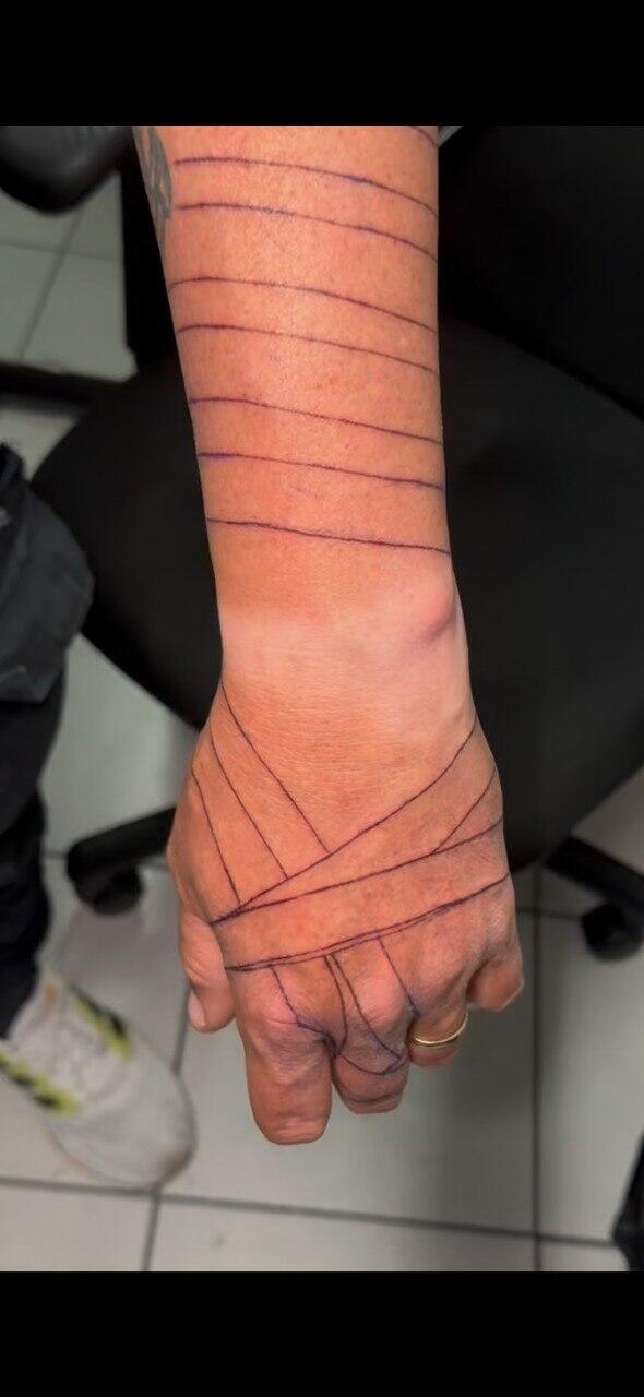 סימני רצועות התפילין שקועקעו על הזרוע