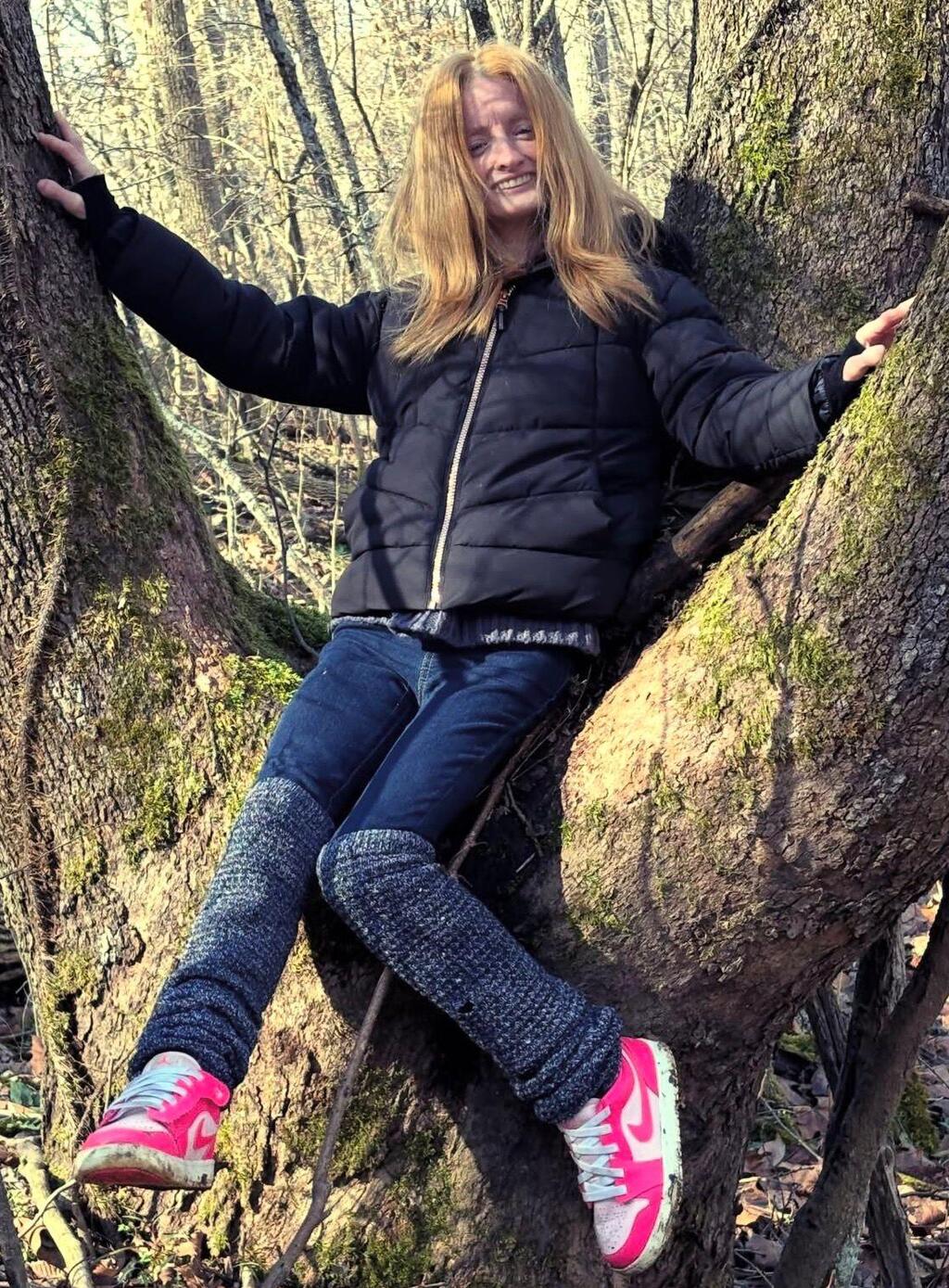 טיפאני וודקינד, הזדקנות מואצת, פרוגריה