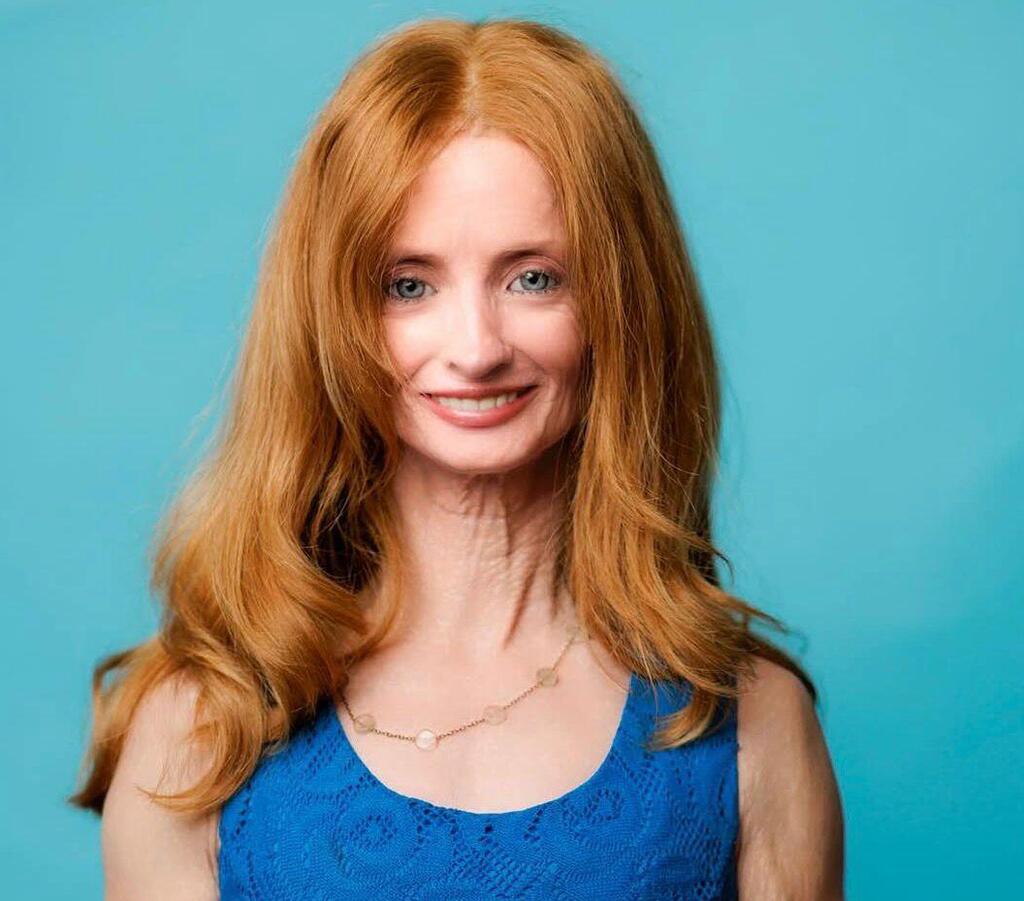 טיפאני וודקינד, הזדקנות מואצת, פרוגריה