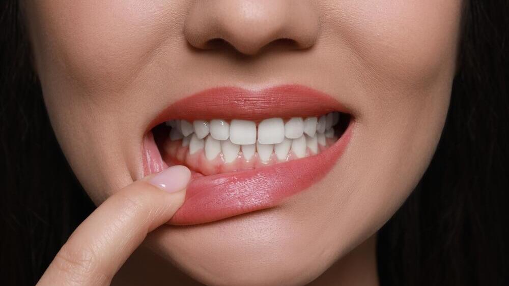 Gums are vital tissue that support the teeth and help maintain overall oral health (Photo: Shutterstock) חניכיים