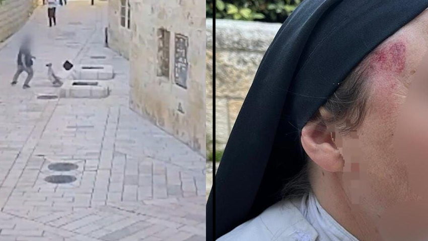 החשוד יונה שרייבר תוקף נזירה בירושלים פניה של הנזירה