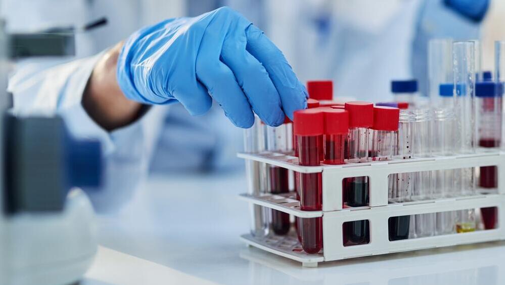 The blood proteins that could reveal prostate cancer risk more than 15 years early (Photo: Shutterstock) בדיקת דם