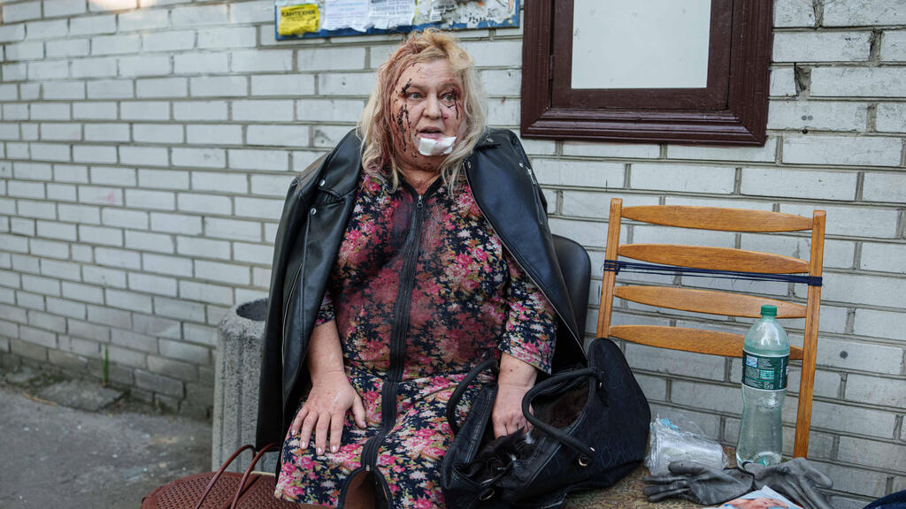 One of those injured in the attack on Kyiv (Photo: Evgeniy Maloletka/AP) מתקפה של רוסיה על קייב אוקראינה