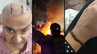 "מכות עד אובדן הכרה, אין עצם שלמה": עדויות מאיראן