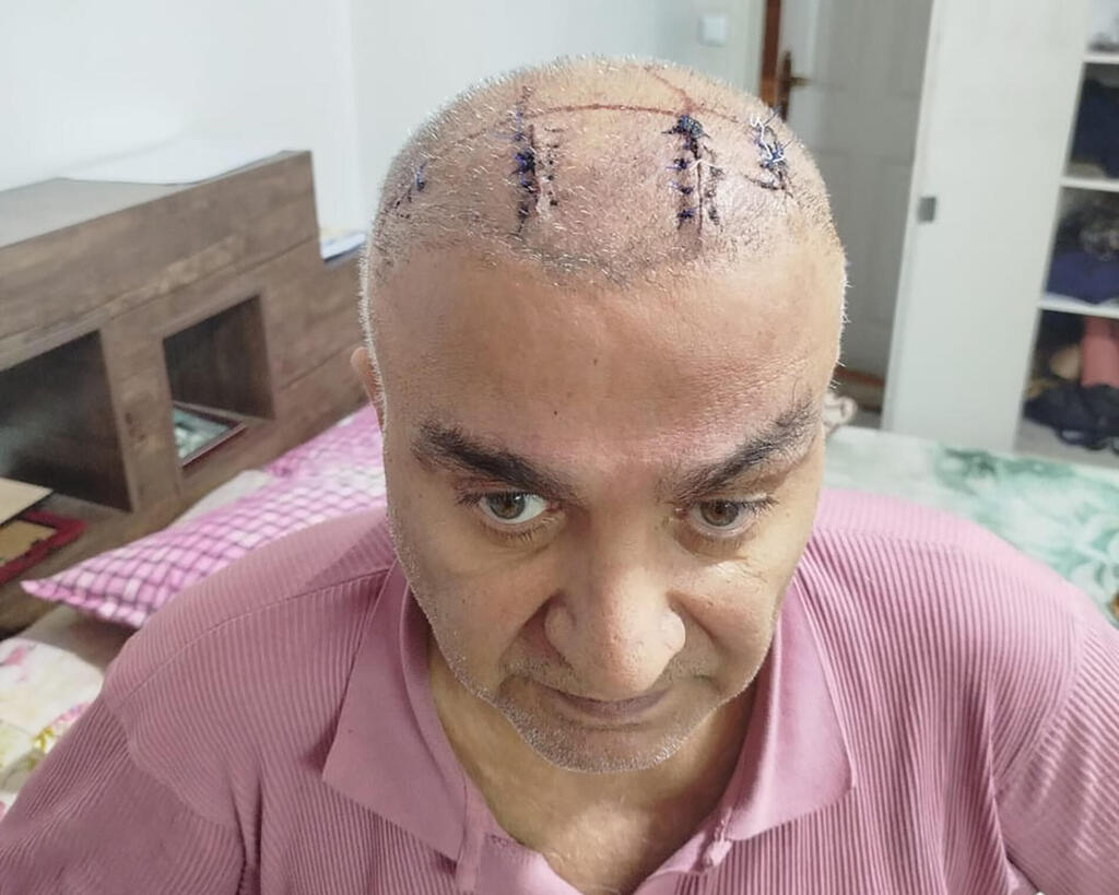 Iranian writer Hamid Asefi severely beaten in his apartment in Iran (Photo: The Guardian) הסופר האיראני חמיד אספי שהוכה קשות בדירתו באיראן