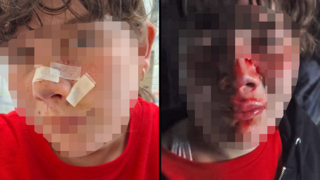 "התעוררתי מצרחות": 11 פצועים במתקפת תנים בכינרת