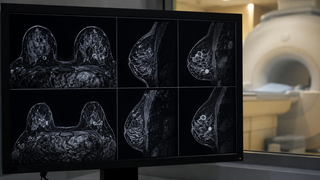 MRI machine