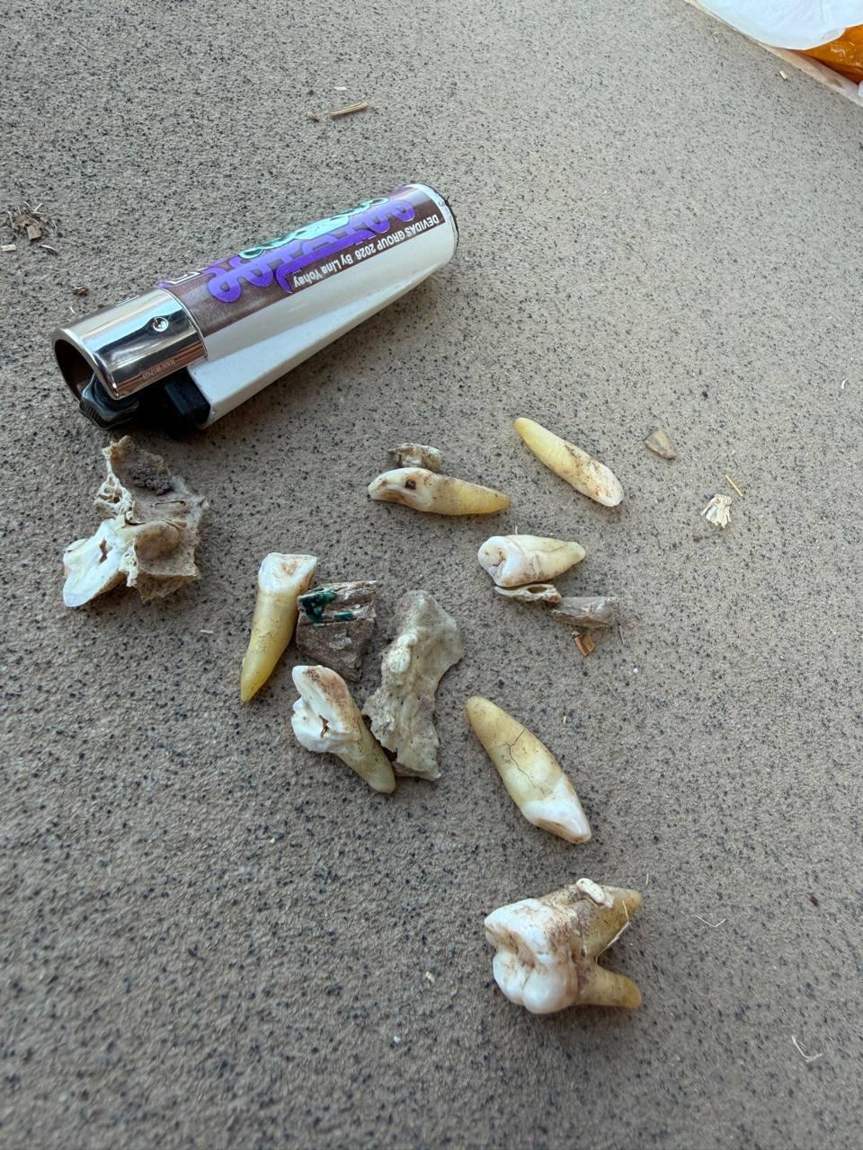 A total of nine teeth and several other bones believed to be human remains were found השיניים שאותרו בכפר עזה