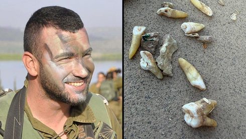 השיניים שאותרו בכפר עזה