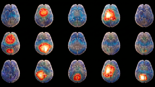 Brain grid 