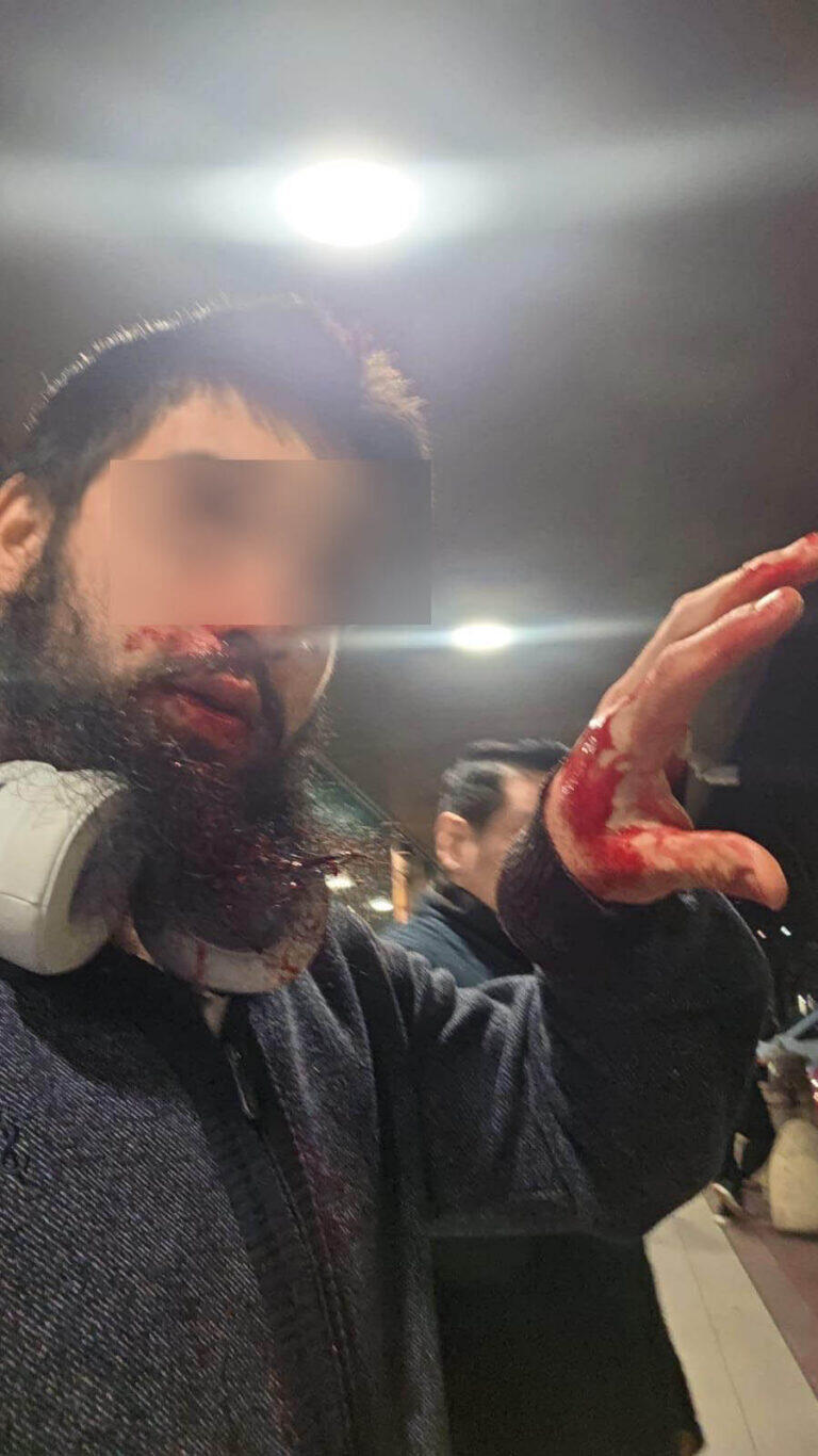 Jewish Argentinian tourist attacked in Italy (Photo: Courtesy) Jewish Argentinian tourist attacked in Italy
