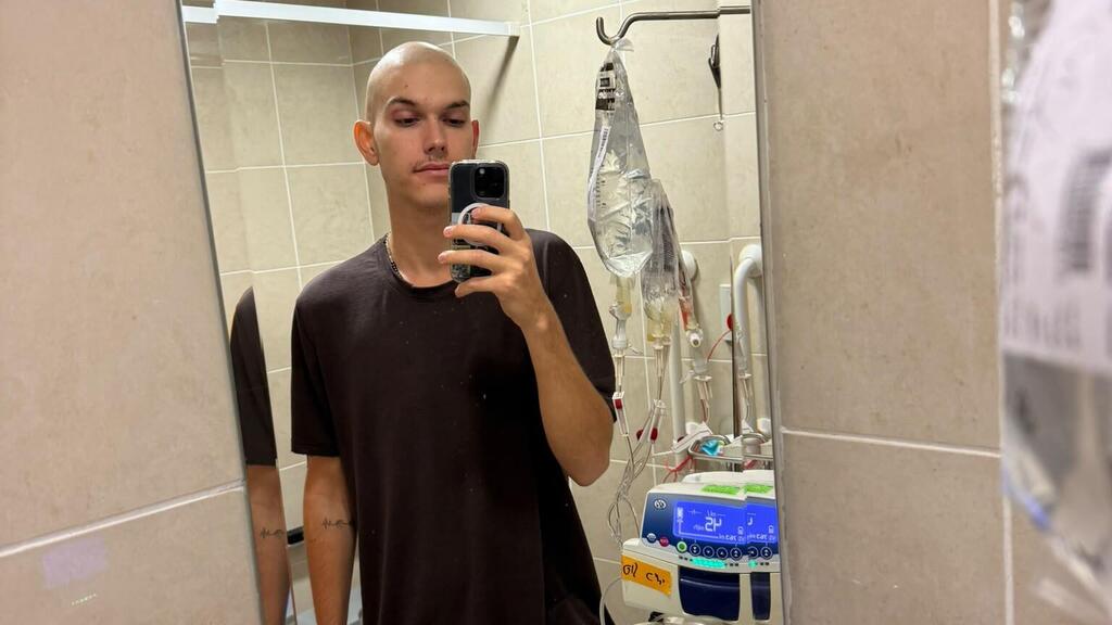 Saying goodbye to his hair during aggressive treatment (Photo: Courtesy) עומר אלון אובחן עם סרטן במהלך טיול גדול במזרח הרחוק