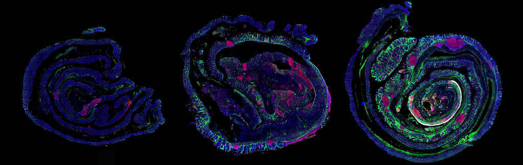 Mouse colon: 80 days after temporary inflammation, collagen 18 buildup and an active immune response remained, mainly in the area where ulcerative colitis develops in humans (Photo: Weizmann Institute of Science) מעי גס של עכבר: 80 יום לאחר דלקת חולפת ניכרו הצטברות קולגן 18 ותגובה חיסונית פעילה, בעיקר באזור שבו מתפרצת קוליטיס כיבית בבני אדם
