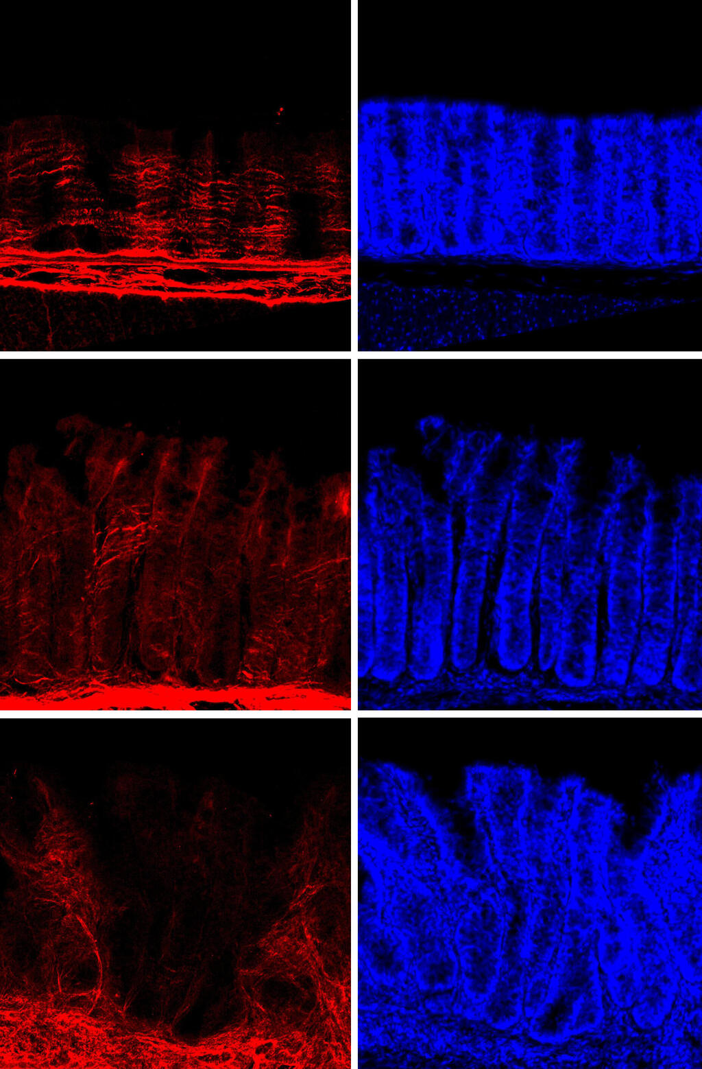 Mouse intestine sample: 80 days after the acute inflammation subsided, collagen fibers remained damaged and the number of pro-inflammatory epithelial cells had increased (Photo: Weizmann Institute of Science) דגימת מעי של עכבר: 80 יום לאחר שהדלקת החריפה חלפה, סיבי הקולגן נותרו פגועים ומספר תאי האפיתל מעודדי הדלקת גדל
