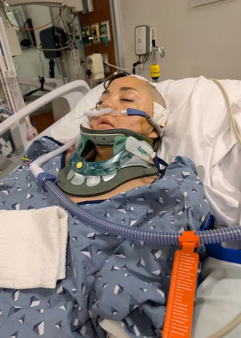 Pamela Guillen underwent surgery and fell into a coma after riding the California roller coaster (Photo: Pamela Guillen) פמלה גיין עברה ניתוח והייתה בתרדמת בעקבות רכבת הרים מסוג X2 בקליפורניה