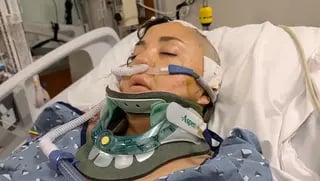 פמלה גיין עברה ניתוח והייתה בתרדמת בעקבות רכבת הרים מסוג X2 בקליפורניה