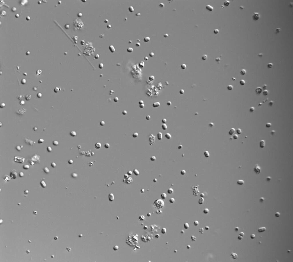 ציאנובקטריה השייכת לסוג Synechococcus