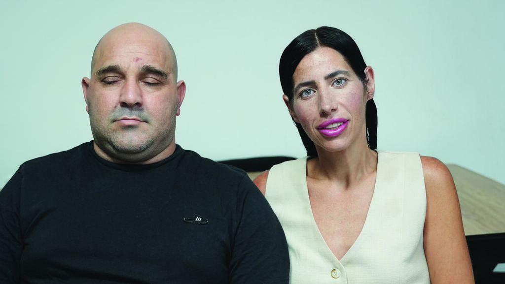 רינת ומאיר קרה, תרומת כליה