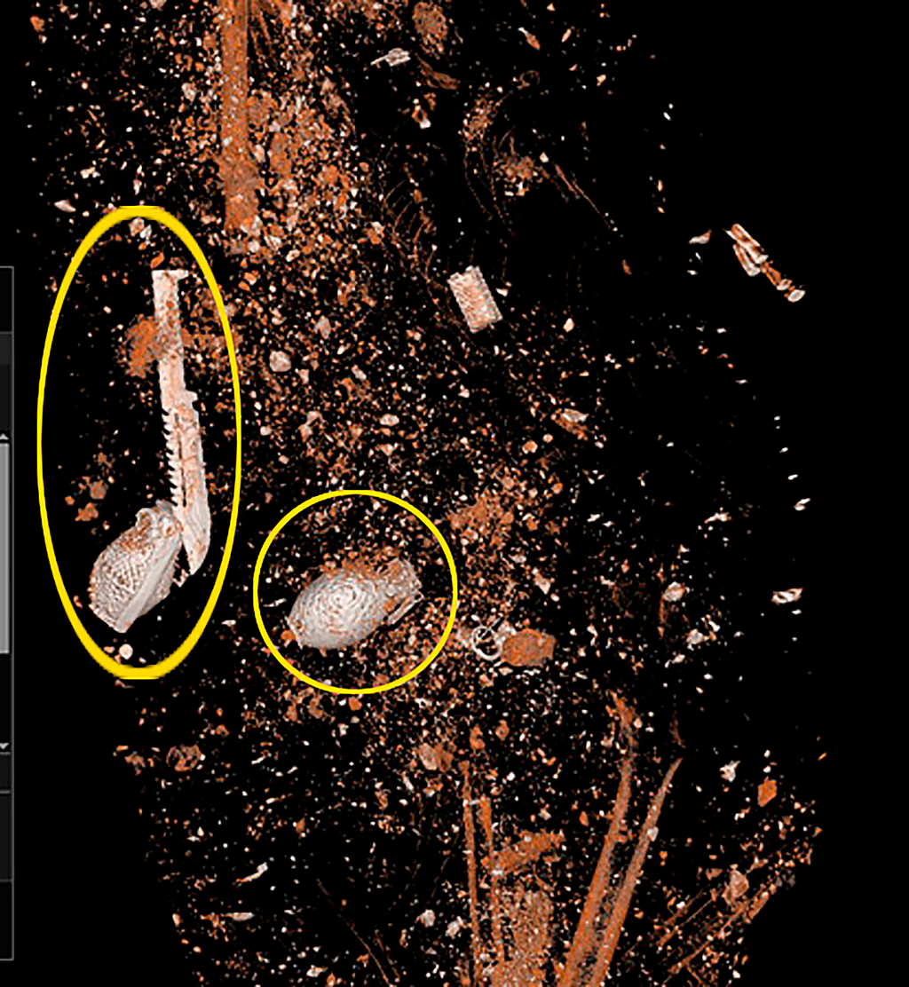 Grenades and a knife on the body of a terrorist placed in a CT scanner (Photo: National Center of Forensic Medicine) עדויות 7 באוקטובר: רימונים וסכין על גופת מחבל שהוכנסה למכשיר CT