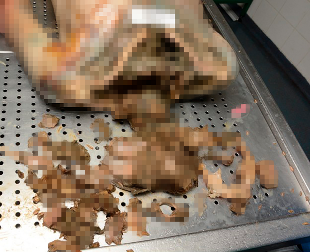 Terrorists ran over a person’s head (Photo: National Center of Forensic Medicine) עדויות 7 באוקטובר: המחבלים דרסו ראש של אדם