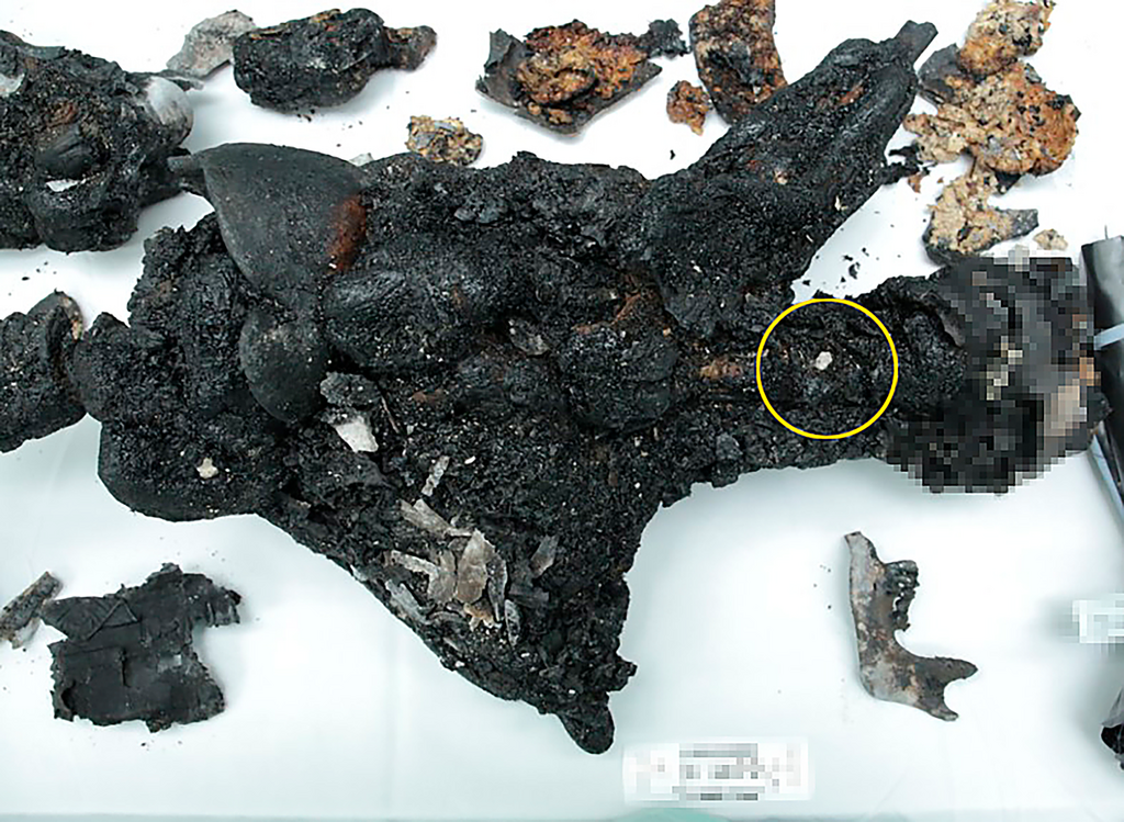 Horrifying brutality: Soot in the trachea proves that a person was burned alive (Photo: National Center of Forensic Medicine) עדויות 7 באוקטובר: פיח בקנה הנשימה מוכיח שאדם נשרף בחיים