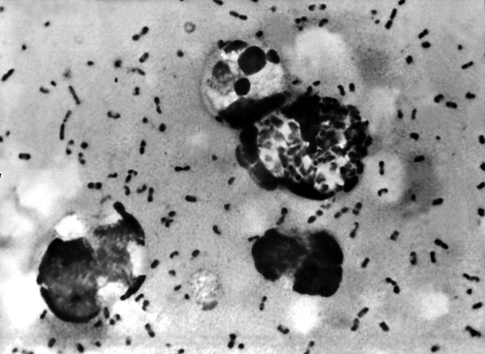 Plague bacteria under a microscope (Photo: shutterstock) חיידקי דבר