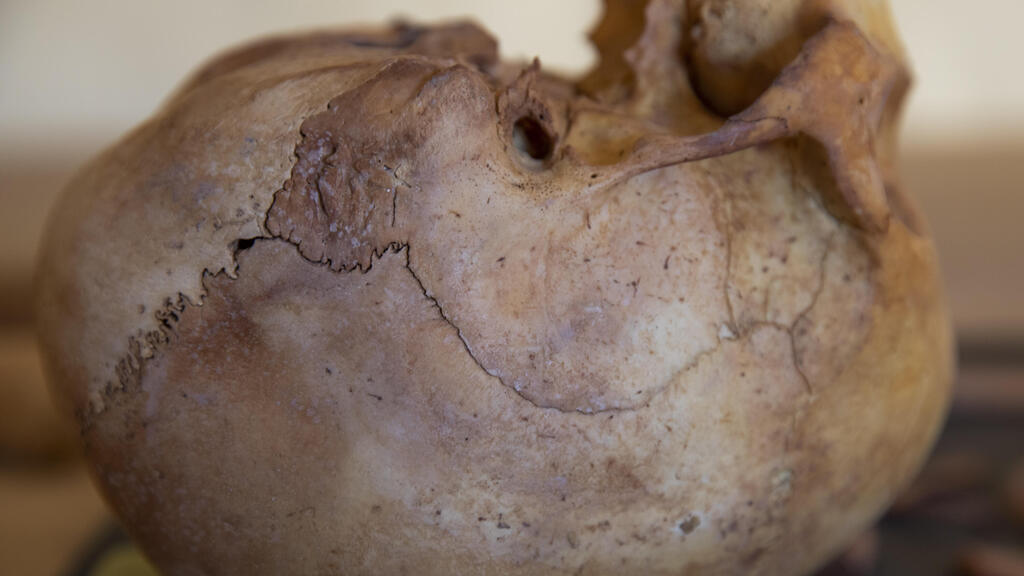 A skull dating to around 3000 B.C (Photo: Nariman El-Mofty/AP) גולגולת המתוארכת לסביבות שנת 3000 לפני הספירה